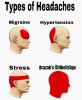 Types of Headaches 27022021101236.jpg